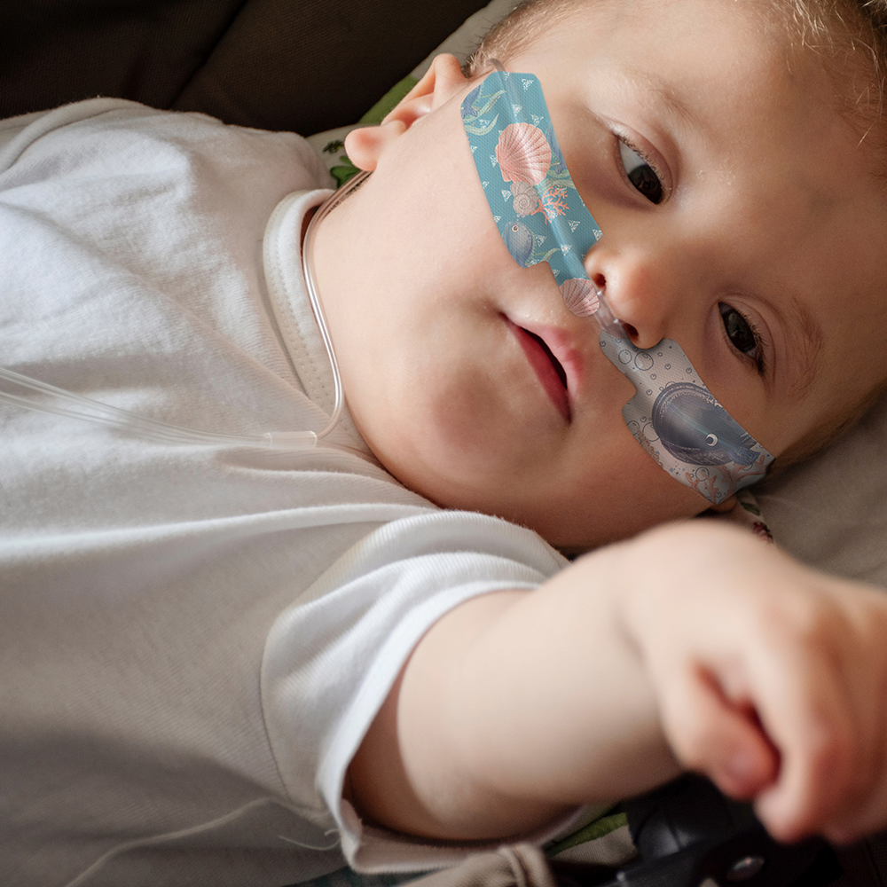 Nasogastric Patch x 10 pack